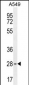 BTF3 Antibody (N-term)